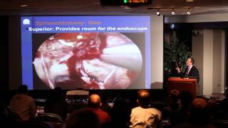 Designing a Midline Anterior Skull Base Approach Endoscopic Endonasal Skull Base Surgery [upl. by Kraus]