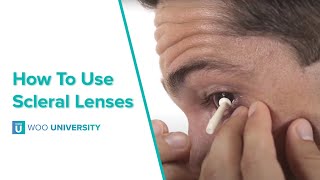 How To Insert and Remove Scleral Lenses [upl. by Alleciram920]