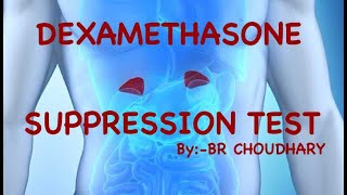 DEXAMETHASONE SUPPRESSION TEST CUSHING DISEASE  CUSHING SYNDROME  DEXAMETHASONE STRESS TEST [upl. by Nalloh571]