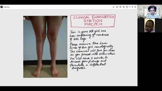 MRCPCH Clinical Examination discussion Xtended Clinical Clinical examination amp Video Station mocks [upl. by Avir832]