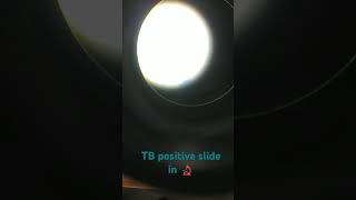 TB positive slide in microscope prathana newsong 🔬 microbiology short [upl. by Butte]