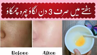 Winter Skin Care Routine  Homemade Face Oil For Glowing Skin In 3 Days [upl. by Leirvag]