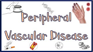 Peripheral Vascular DiseasePVD Causes Signs amp Symptoms Diagnosis ampTreatment [upl. by Biamonte]