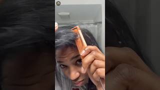 Dandruff removal at home 🏡 [upl. by Manley]