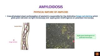 Amyloidosis  Definition physical and biochemical properties of amyloid [upl. by Aicileb896]