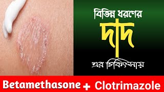 Betamethasone amp Clotrimazole Cream bangla  দাউদের সবচেয়ে ভালো ঔষধ  দাদ চুলকানি দূর করার উপায় [upl. by Ecnarolf]