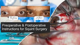 Preoperative amp Postoperative Instructions for Squint Surgery  Squint Surgery  Vision Eye Centre [upl. by Harms729]