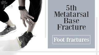 5th Metatarsal Base Fracture  foot fracture [upl. by Saxe]