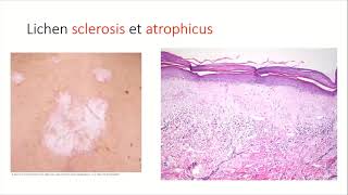 Introduction of Dermatopathology DrAbdelrahman Reda [upl. by Ranie863]