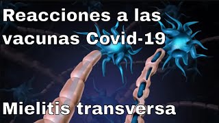 Parálisis y autoinmunidad nuevos eventos adversos de vacunas contra Covid19 [upl. by Kenneth]