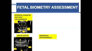 Fetal growth assessment Obstetrics dopplers and Clinical application Mr A Zanga [upl. by Verne890]