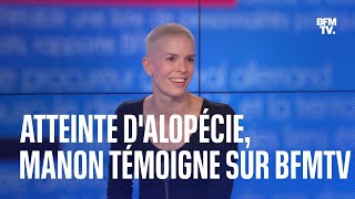 Atteinte dalopécie Manon témoigne sur BFMTV [upl. by Mikeb]