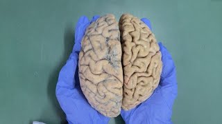 CEREBRUM  EXTERNAL FEATURES  SULCI AND GYRI  NEUROANATOMY Part  2 [upl. by Ebag]