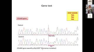 Alport online workshop 010720 Exon skipping therapy for Alport Syndrome [upl. by Corwin]