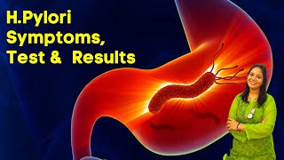 HPylori Test in Hindi  Symptoms Test and Results in Hindi [upl. by Teews]