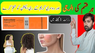 hydrocortisone cream uses in Urduhydrocortisone cream how to usehydrocortisone cream uses in Hindi [upl. by Nemlaz803]