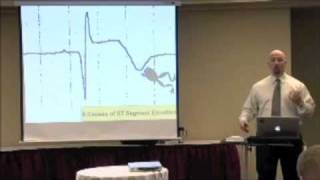 The 6 Causes ST Segment Elevation on an EKG ECG [upl. by Nnayecats]