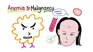 Anemia and Malignancy [upl. by Anod200]