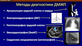 ДМЖП или дефект межжелудочковой перегородки причины симптомы диагностика и лечения ДМЖП [upl. by Cirdek]