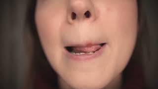 Cold Sores  Causes Symptoms and Remedy [upl. by Matilde752]