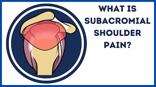 What is subacromial shoulder pain [upl. by Nahraf502]