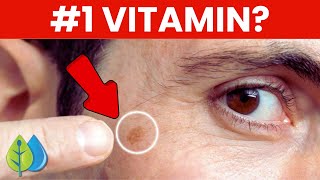 Top 3 Nutrients to Remove Age Spots [upl. by Lief219]