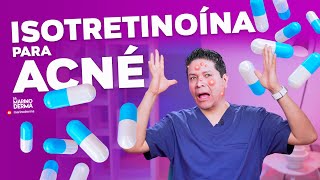 ISOTRETINOÍNA PARA ACNÉ  DERMATÓLOGO OPINA [upl. by Alegnave]