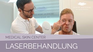 Laserbehandlung im Medical Skin Center – Dr Bacman [upl. by Calley]