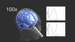 Impedance Change of Brain Pulsation [upl. by Rettke]