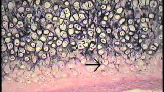 Cartilage and Bone Histology FreeMedEd [upl. by Durtschi]