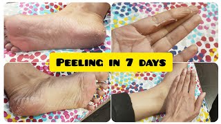 HANDS amp FEET PEELING MASK  RESULTS IN 7 DAYS [upl. by Odnumyar]