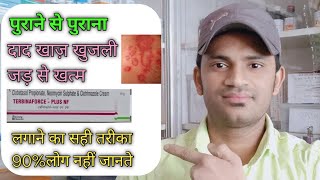 Terbinaforce plus nf cream use benefits and Side effects full review in hindi [upl. by Brenda]