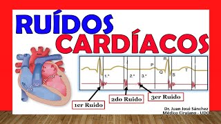 🥇 RUIDOS CARDÍACOS R1 R2 R3 y R4 ¡Fácil Explicación [upl. by Hortensa]