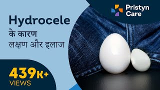 Hydrocele के कारण लक्षण और इलाज  Testicle swelling  For FREE Consultation Call On 6366528295 [upl. by Zulaledairam]