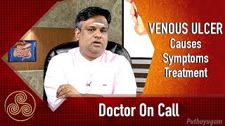 Diagnosis and Treatment of Venous Ulcers  Doctor On Call  23022018 [upl. by Jangro]