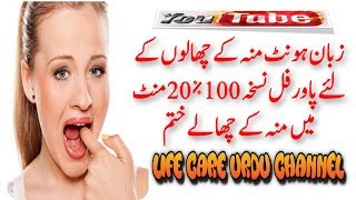 Mouth Blisters Treatment In Urdu   Blister In Mouth Treatment  Muh Ke Chalo Ka Ilaj [upl. by Lipski]