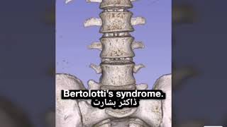 Bertolotti’s syndrome [upl. by Codee]