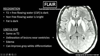 MRI Sequences [upl. by Dubenko561]