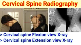 Cervical spine radiography  Flexion amp Extension view Xray  In radiography  By BL Kumawat [upl. by Wittenburg]