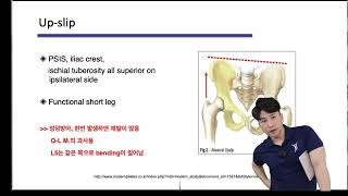 골반이해하기 36 Rotation slip flare [upl. by Eseuqcaj]