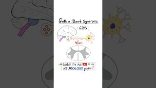 GuillainBarré Syndrome GBS  Part 2…anatomy biology science neuroscience nurse doctor [upl. by Tice316]