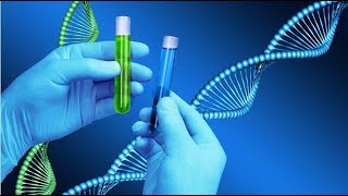 Anti Double Strand DNA Test [upl. by Annayd]