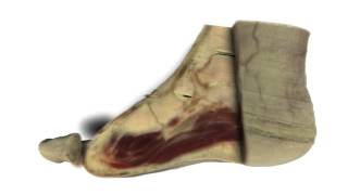 The Visible Human Project  leg of male cadaver [upl. by Abbott]