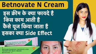 Betamethasone Valerate and Neomycin Skin Cream  Betnovate N Cream for Face  Uses [upl. by Nabe975]