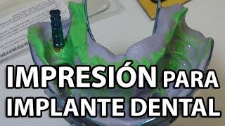 Impresión para IMPLANTE DENTAL Posterior👅 dental [upl. by Deehsar]