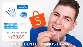 MINHA REAL OPINIÃO CLAREADOR DENTAL DA SHOPEE anos depois de usar [upl. by Gefell]