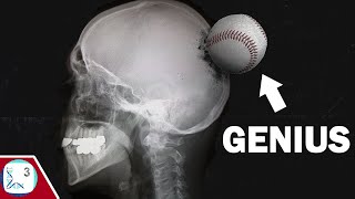 How a Baseball Injury Made A Genius Savant Syndrome [upl. by Body]