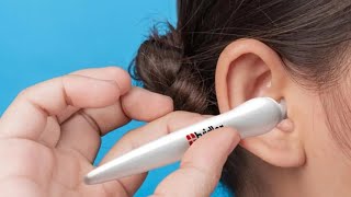 Tvidler Ear Wax Cleaner Must Watch The Future of Ear Hygiene  Tvidler Pro Ear Cleaner Reviews [upl. by Notgnirra979]