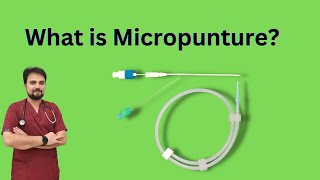 What is a Micropunctur kit [upl. by Notanhoj]