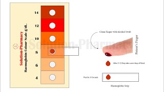 Estimation of Haemoglobin  Colour Scale Method to Determine Haemoglobin in Blood Sample  Animation [upl. by Nyrhtak]